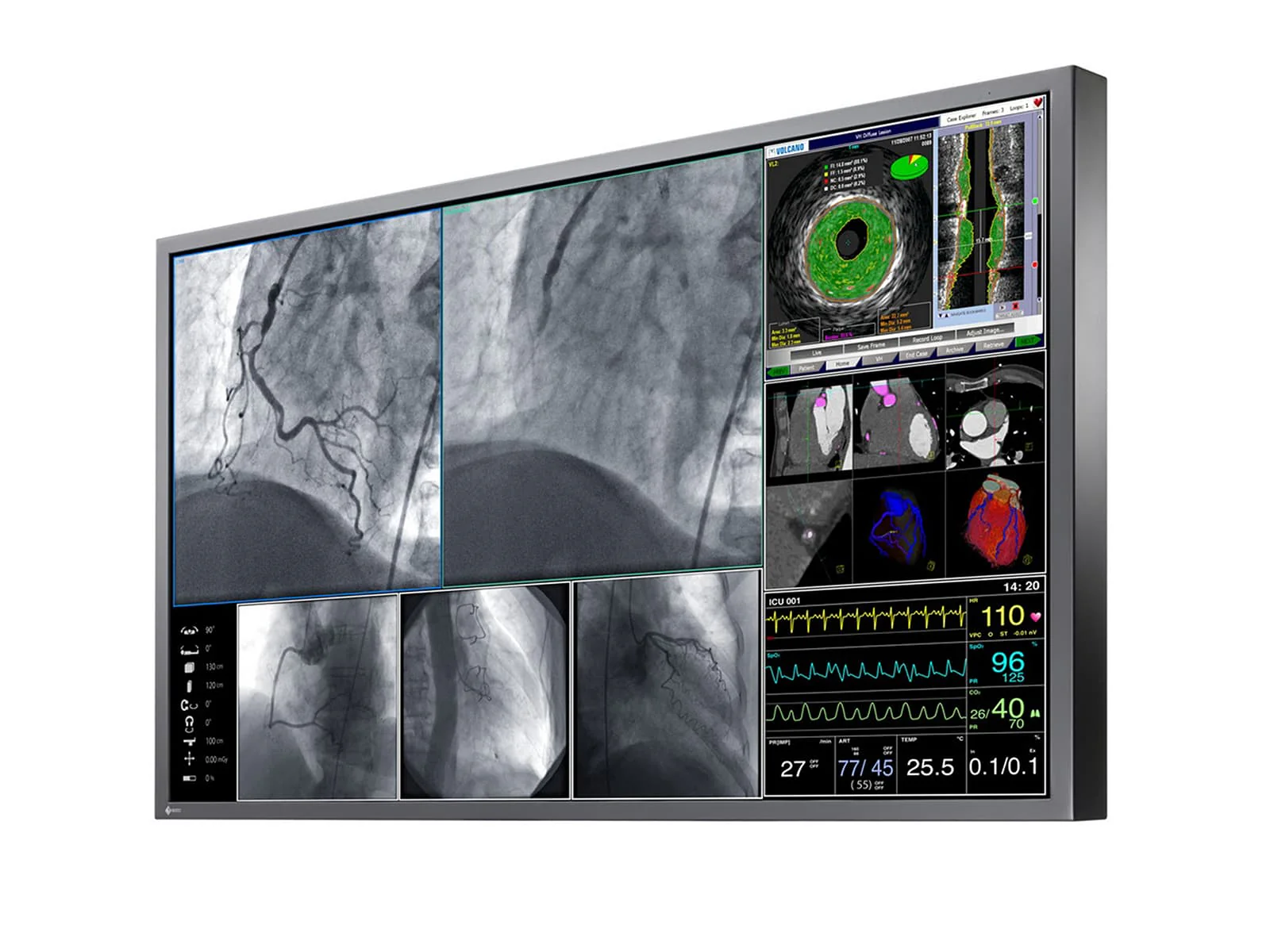 Eizo RadiForce LX600W 60.1" 8MP 4K Surgical Medical Display Monitor (LX600W) 2 Eizo RadiForce LX600W 60.1" 8MP 4K Surgical Medical Display Monitor (LX600W)