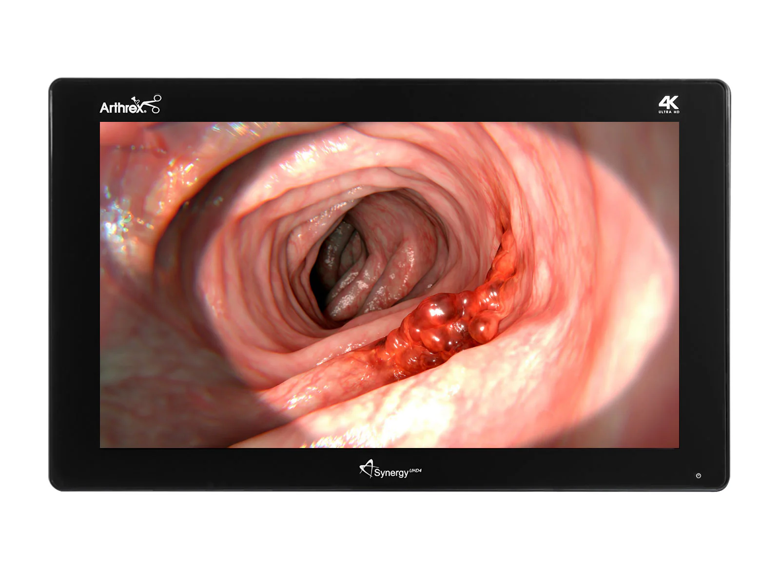 Barco Arthrex SynergyUHD4 32" 4K Surgical Medical Display Monitor (AR-3250-3210)