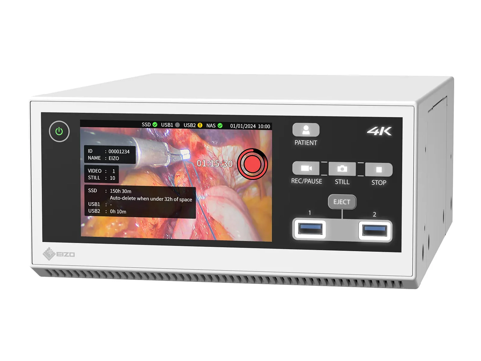 Eizo CuratOR MIR-1 4K/60p Recorder for Medical Images (MIR-1) 2 Eizo CuratOR MIR-1 4K/60p Recorder for Medical Images (MIR-1)