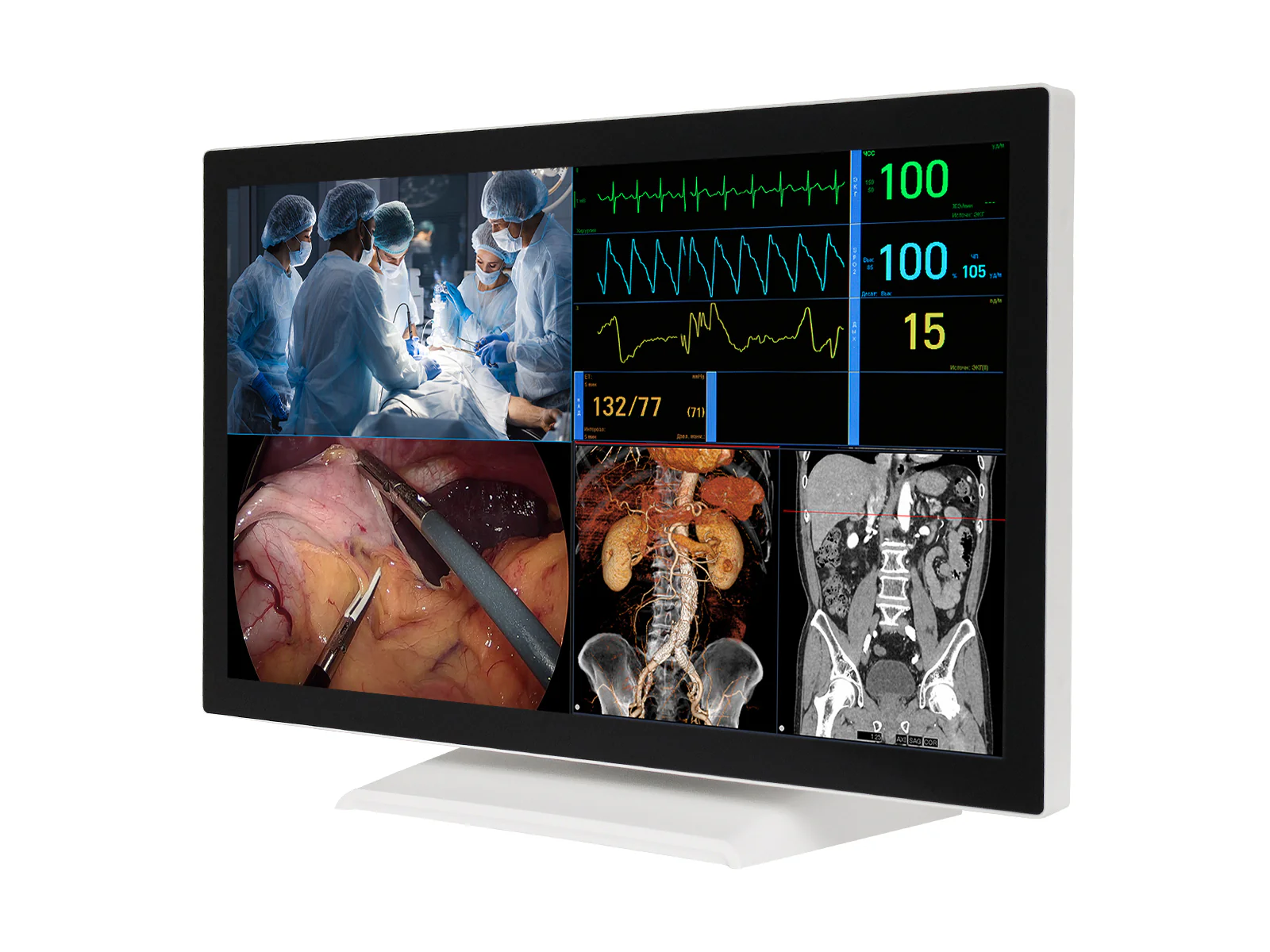Barco AMM 215WTTP 21.5” Full HD Touchscreen Color Clinical Review Display Monitor 2 Barco AMM 215WTTP 21.5” Full HD Touchscreen Color Clinical Review Display Monitor