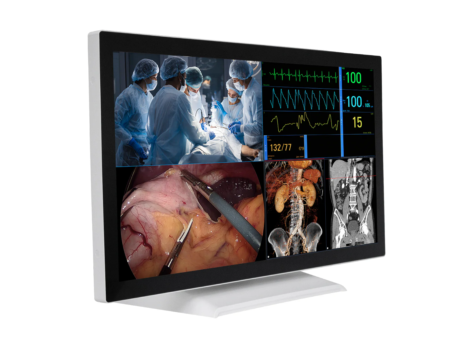 Barco AMM 215WTTP 21.5” Full HD Touchscreen Color Clinical Review Display Monitor 3 Barco AMM 215WTTP 21.5” Full HD Touchscreen Color Clinical Review Display Monitor