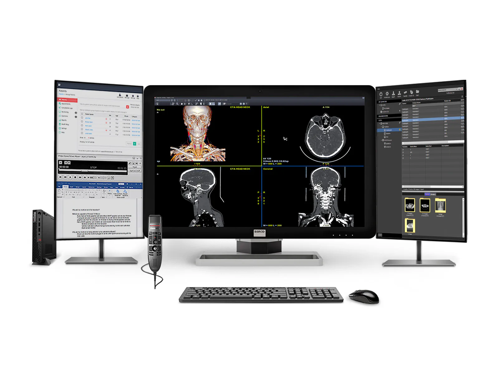 Barco Coronis Fusion MDCC-6430 6MP 30″ Radiology PACS Display + Lenovo ThinkStation P3 | i9‑13900 64GB DDR5 Workstation + Philips SpeechMike Trackball Dictation Mic + Dual 24″ HD Worklist Monitors + Nvidia T1000 8GB GPU + Lenovo Keyboard & Mouse