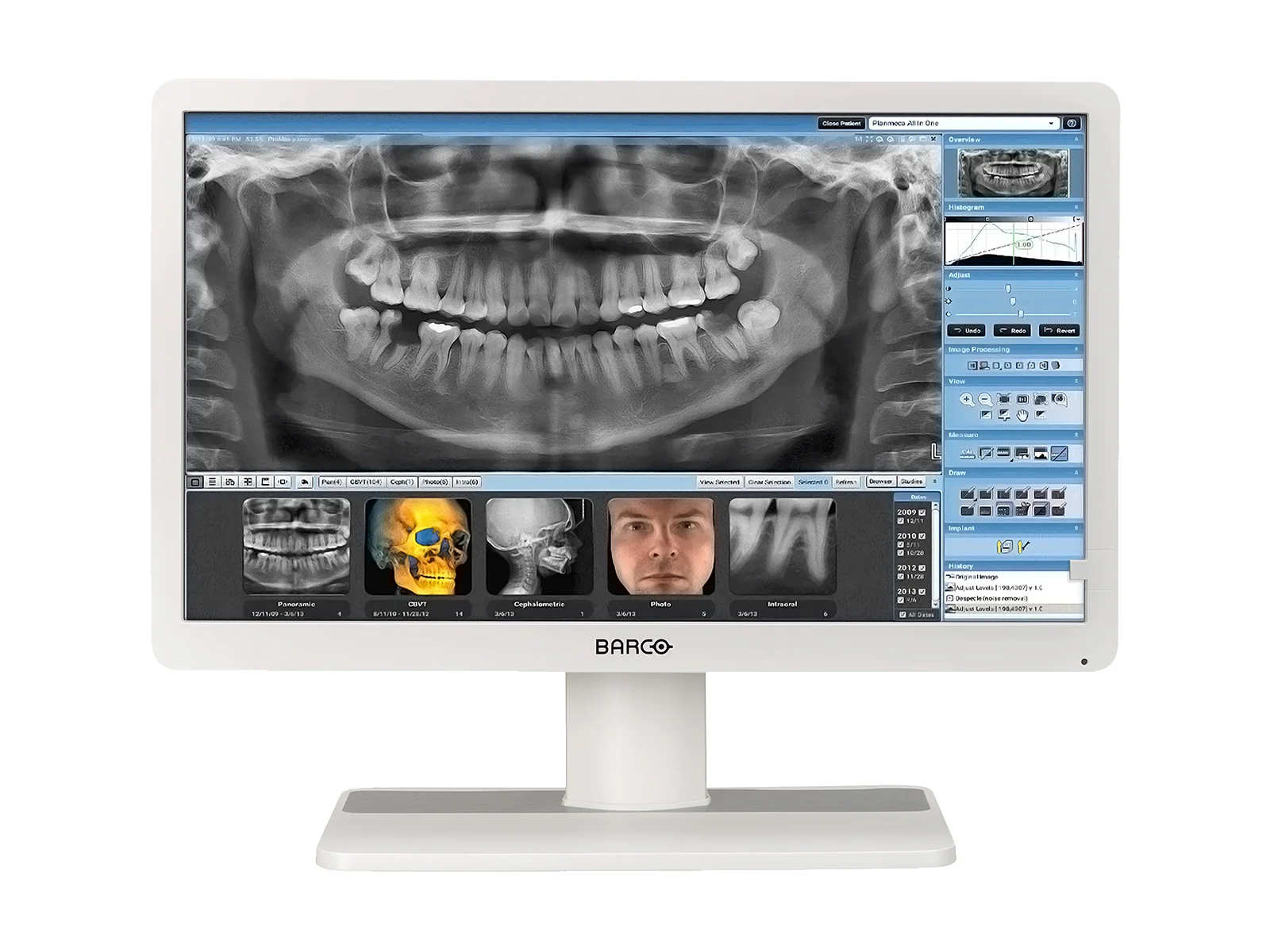 Barco Eonis MDRC-2324 HNEW 2MP 24" Clinical Review Monitor