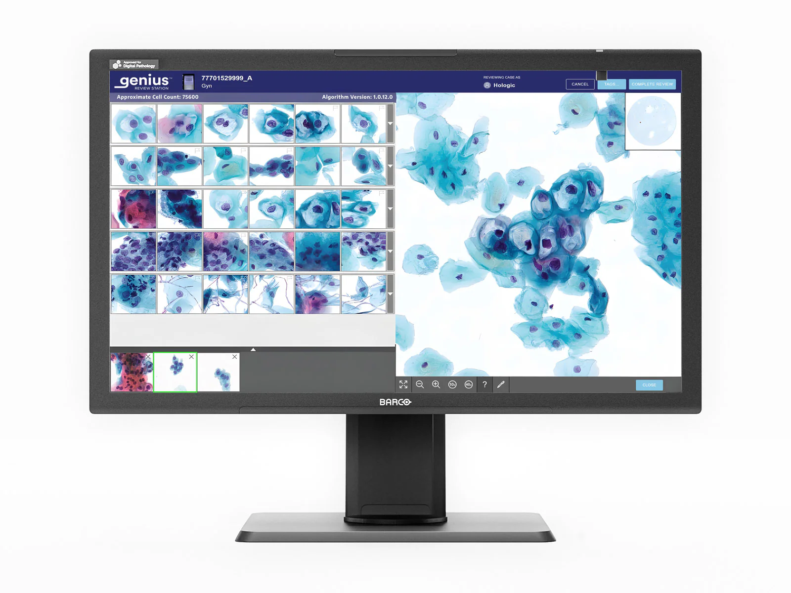 Barco Hologic MDPC‑8127 HLX Genius Review Station 8MP 27" Color Medical Display for Digital Pathology (CMP01669)