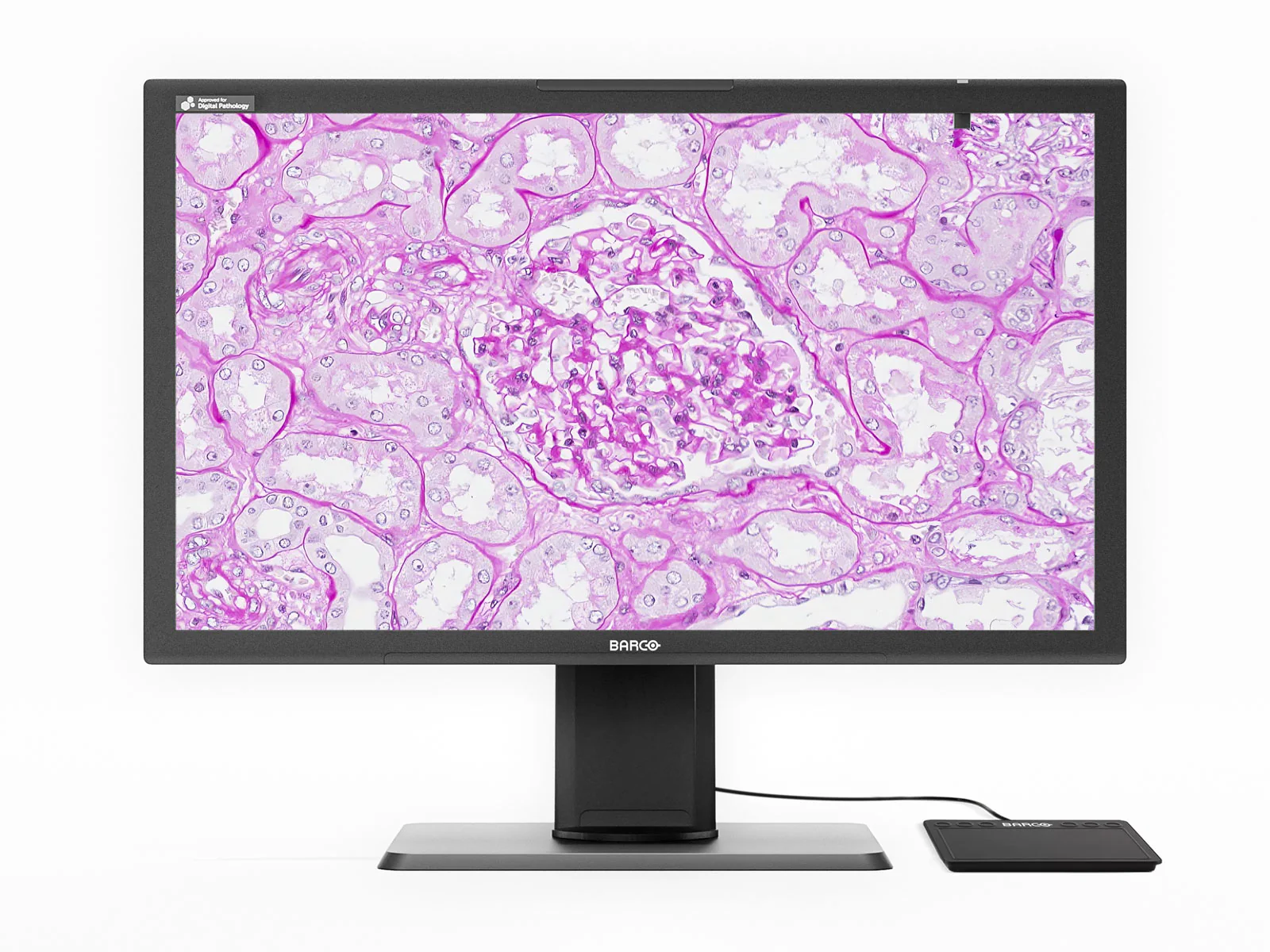 Barco MDPC‑8127 8MP 27" Color Digital Pathology Display with MXRT-4700 (K9610269B)