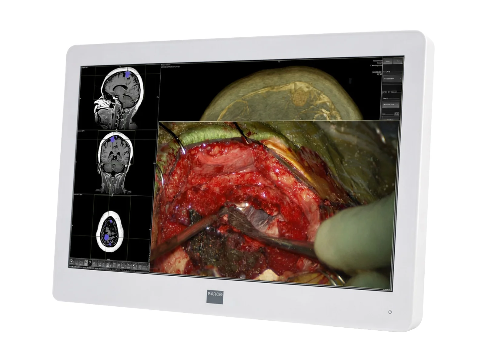 Barco MDSC-2224 MNA 24" 2MP FHD 1920 x 1200 Surgical Endoscopy Medical Display Monitor (K9307913) 2 Barco MDSC-2224 MNA 24" 2MP FHD 1920 x 1200 Surgical Endoscopy Medical Display Monitor (K9307913)