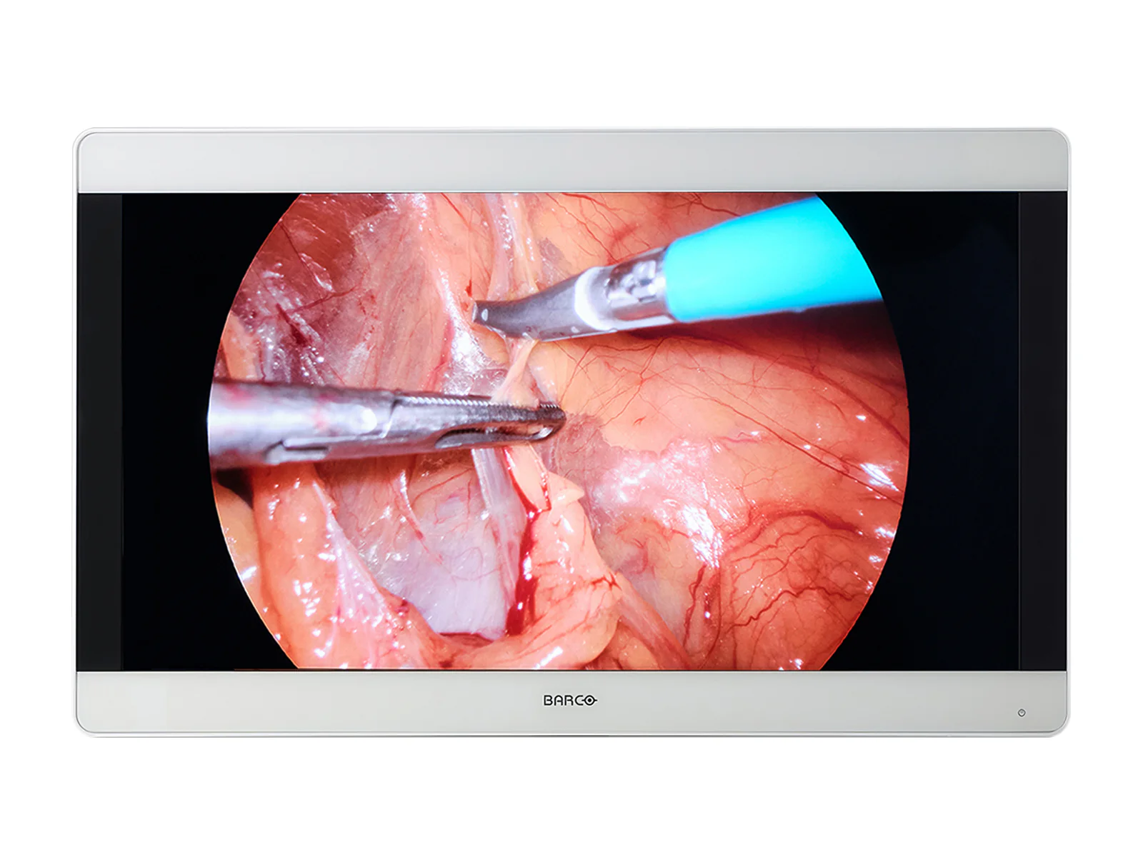 Barco MDSC-8231 MNA 31" 8MP 4K UHD Surgical Medical Display Monitor (K9307927)
