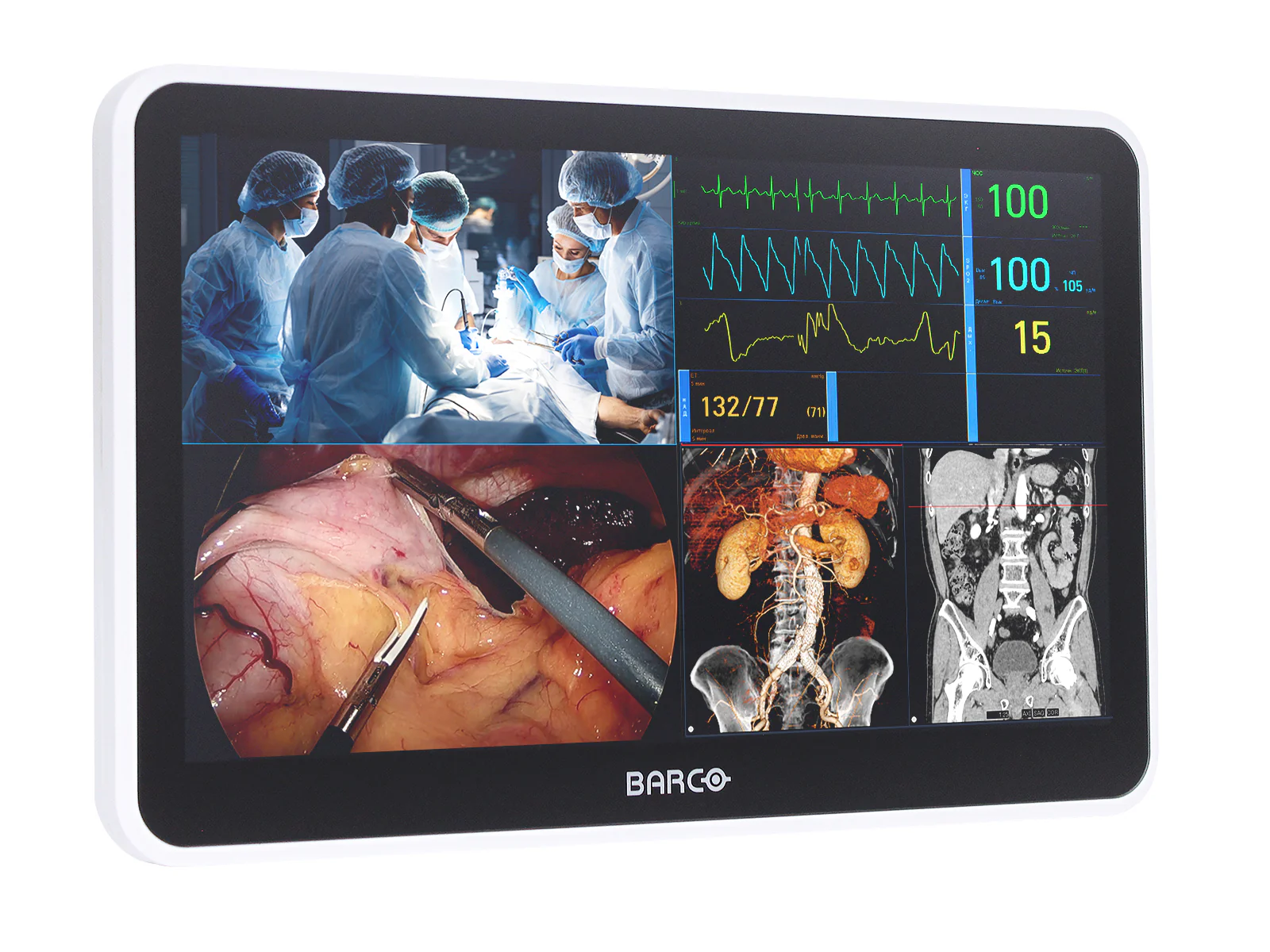 Barco MUIP-2112 12.5" Color Clinical Review Multi-touch Screen Monitor 2 Barco MUIP-2112 12.5" Color Clinical Review Multi-touch Screen Monitor