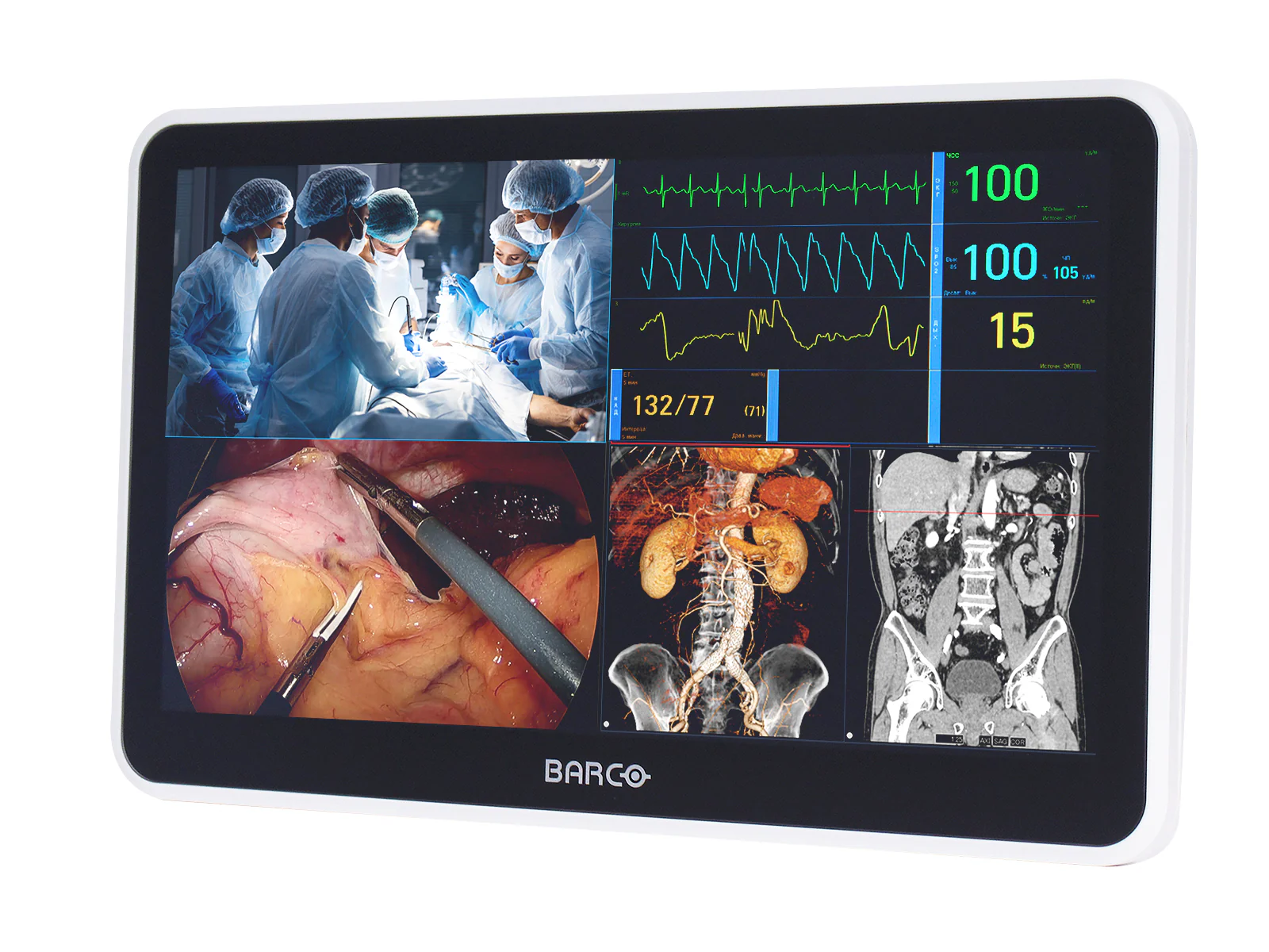 Barco MUIP-2112 12.5" Color Clinical Review Multi-touch Screen Monitor 3 Barco MUIP-2112 12.5" Color Clinical Review Multi-touch Screen Monitor