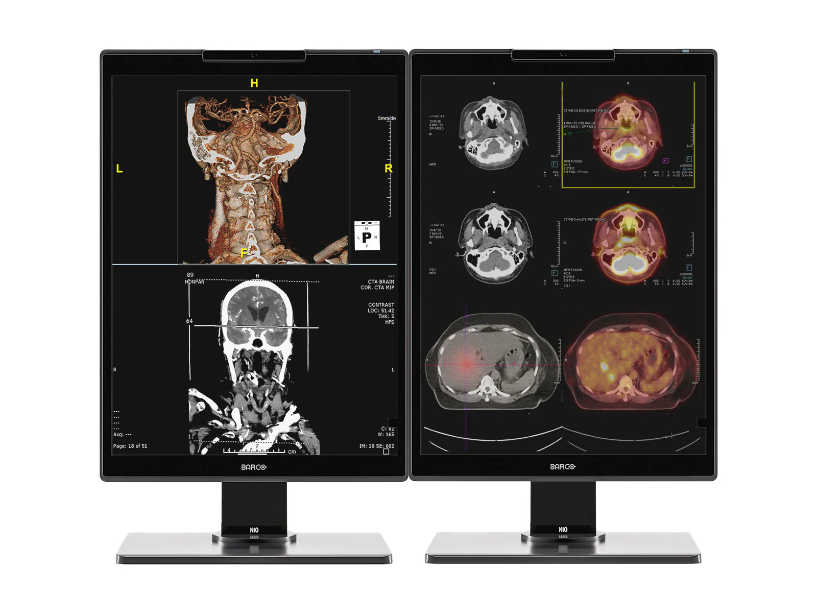 Barco Nio MDNC-3521 3MP 21" Color PACS Diagnostic Radiology Display Monitor