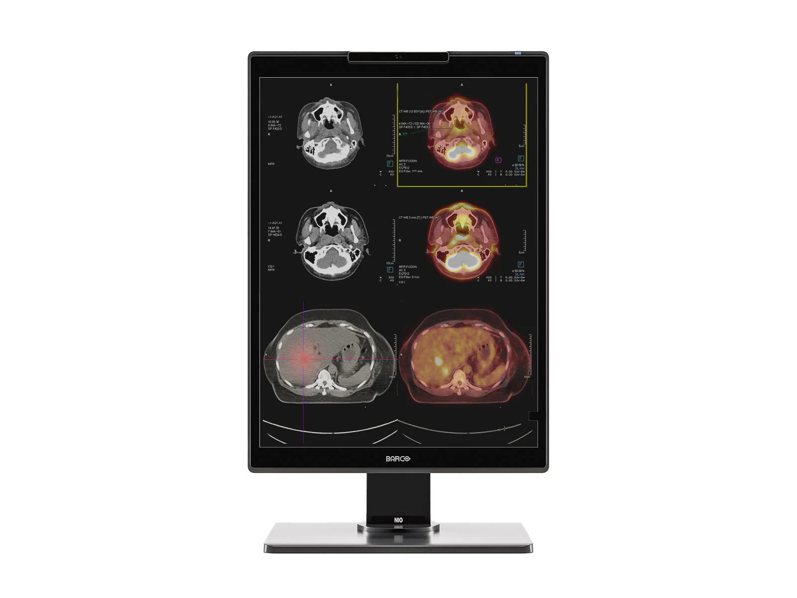 Barco Nio MDNC-3521 3MP 21" Color PACS Diagnostic Radiology Display Monitor 2 Barco Nio MDNC-3521 3MP 21" Color PACS Diagnostic Radiology Display Monitor