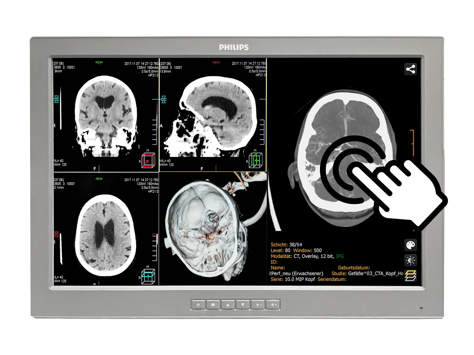 Barco P240-LTv Touchscreen MED24ESB 24" 2MP Philips DICOM Surgical Display Monitor by Fimi Barco (P240-LTv)