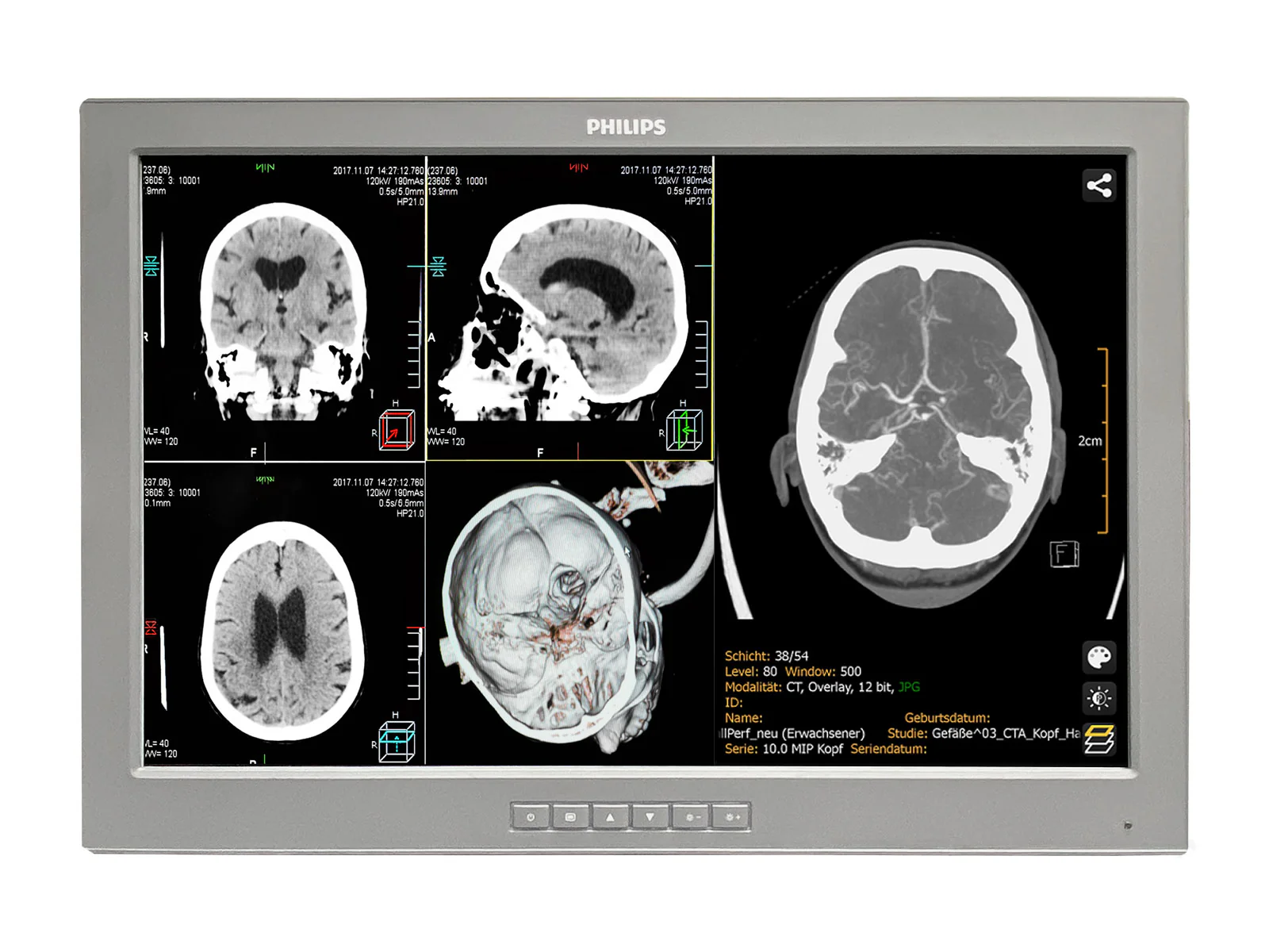 Barco P240-LTv Touchscreen MED24ESB 24" 2MP Philips DICOM Surgical Display Monitor by Fimi Barco (P240-LTv) 2 Barco P240-LTv Touchscreen MED24ESB 24" 2MP Philips DICOM Surgical Display Monitor by Fimi Barco (P240-LTv)