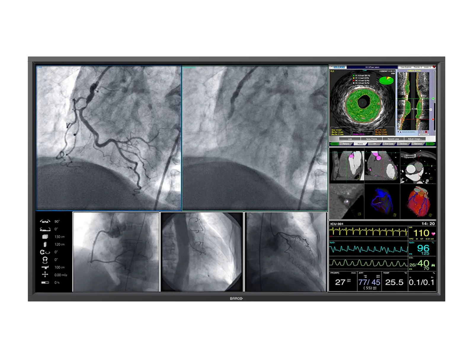 Barco Steris MDSC-8258 RLG 58" 8MP 4K Surgical Medical Display Monitor (K9307852 / RBDV58MG8MP)