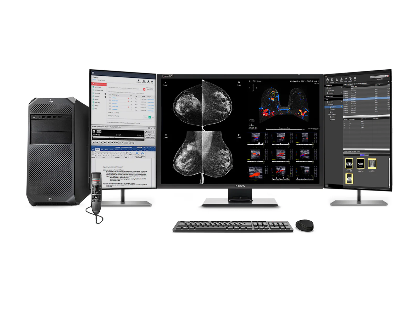 Complete Mammography Reading Station | Barco 12MP MDNC-12130 Color LED Monitors | HP Workstation | Dictation Microphone (LFH3500) | Worklist Monitors (12130Z4G4R)