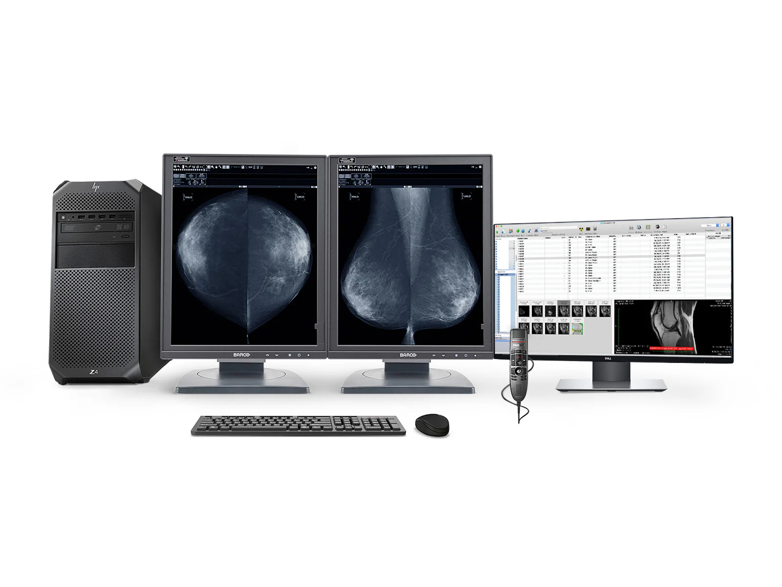 Complete Mammography Reading Station | Barco MDMG-5221 5MP Grayscale 3D-DBT Displays | HP Workstation | Dictation Mic | Worklist Monitor (MD5221Z4R)