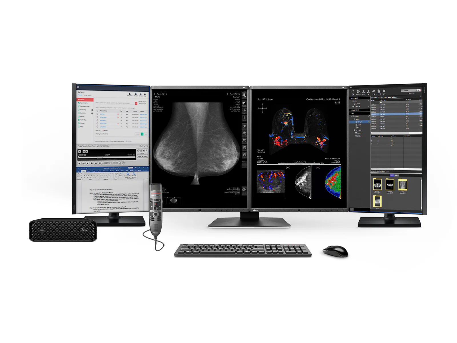 Complete Mammography Reading Station | Eizo Radiforce RX570 5MP Color Mammography Monitors | HP Z2 Mini G9 Workstation | Dictation Mic | Worklist Monitors (RX560Z2MNG9)