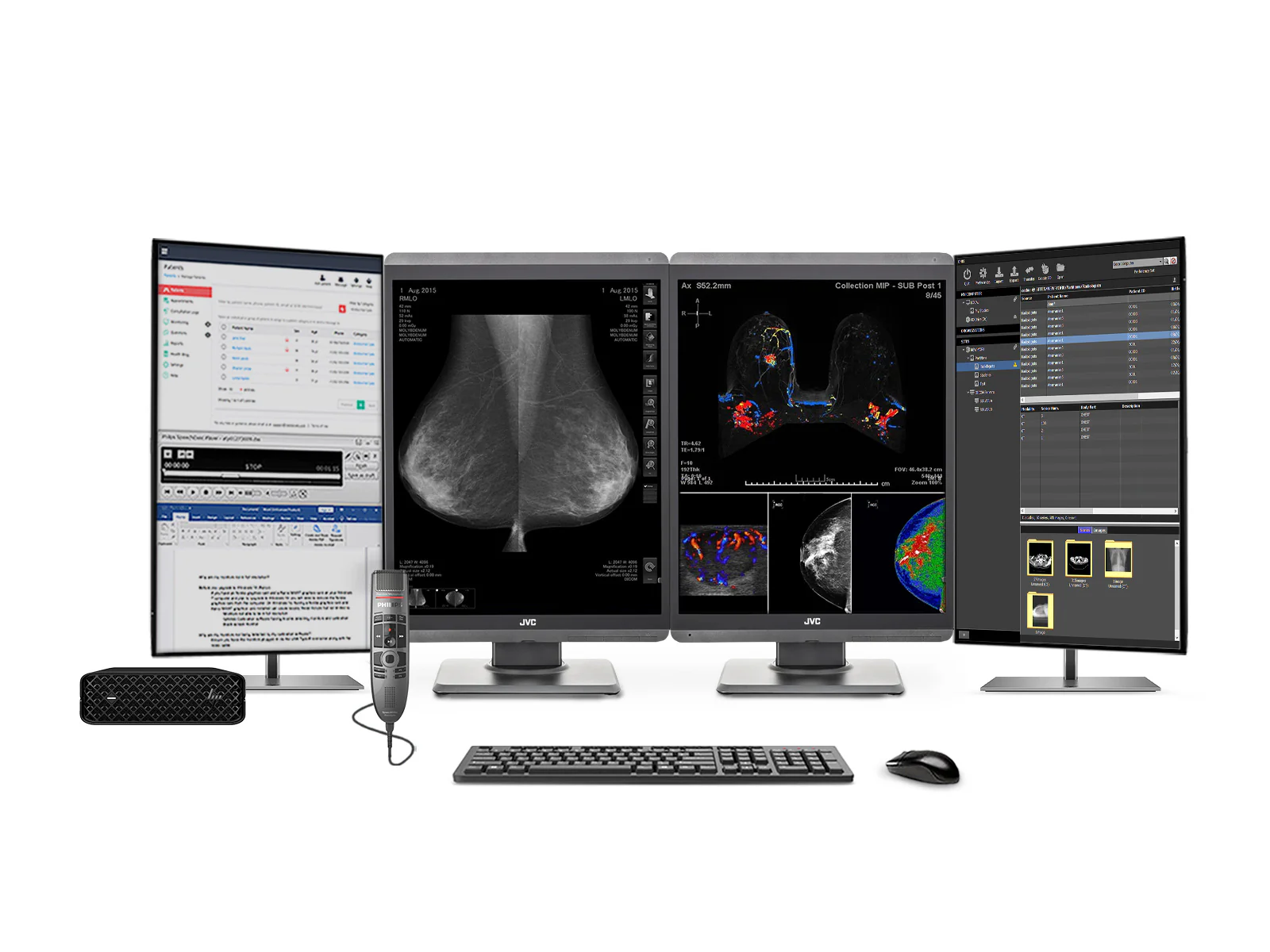 Complete PACS General Radiology Station | Eizo Radiforce MX215 2MP Color LED Displays | Business Class Workstation | Dictation Mic | Worklist Monitor (MX215M90T) 2 Complete Mammography Reading Station | JVC Totoku CL-S500 5MP Color 3D-DBT Displays | HP Z2 Mini G9 Workstation | Dictation Mic | Worklist Monitors (S500Z2MNG9)