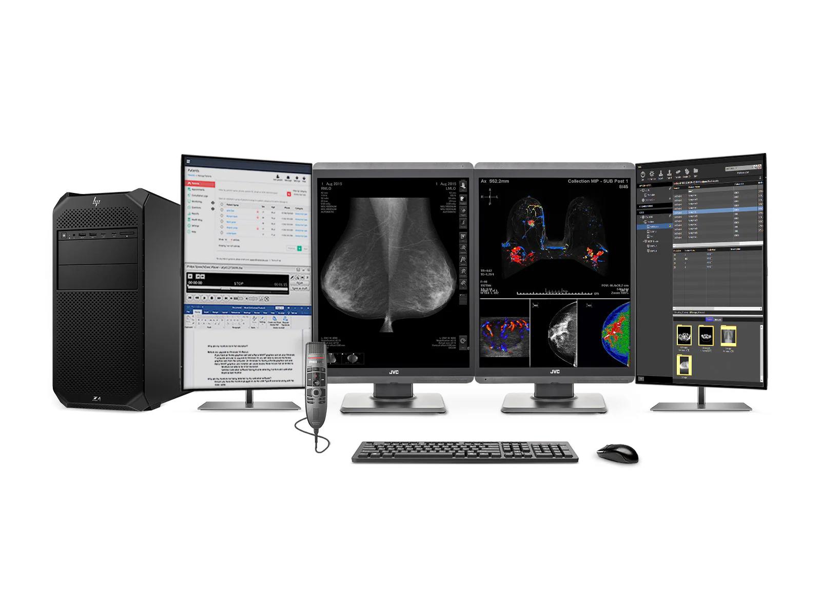 Complete Mammography Reading Station | JVC Totoku CL-S500 5MP Color 3D-DBT Displays | HP Z4 G5 Workstation | Dictation Mic | Worklist Monitors (S500Z4G5) 1 Complete Mammography Reading Station | JVC Totoku CL-S500 5MP Color 3D-DBT Displays | HP Z4 G5 Workstation | Dictation Mic | Worklist Monitors (S500Z4G5)