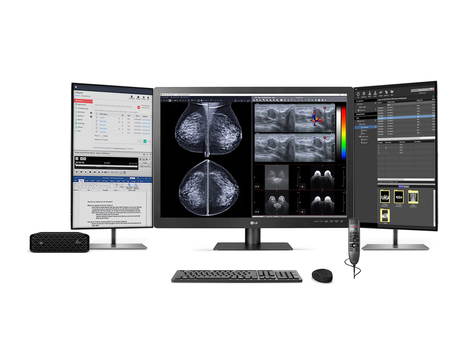 Complete Mammography Reading Station | LG 12MP Fusion 31.5" Color | HP Z2 Mini G9 Workstation | Dictation Mic | Worklist Monitors (31HN713DZ2MNG9) 1 Complete Mammography Reading Station | LG 12MP Fusion 31.5" Color | HP Z2 Mini G9 Workstation | Dictation Mic | Worklist Monitors (31HN713DZ2MNG9)