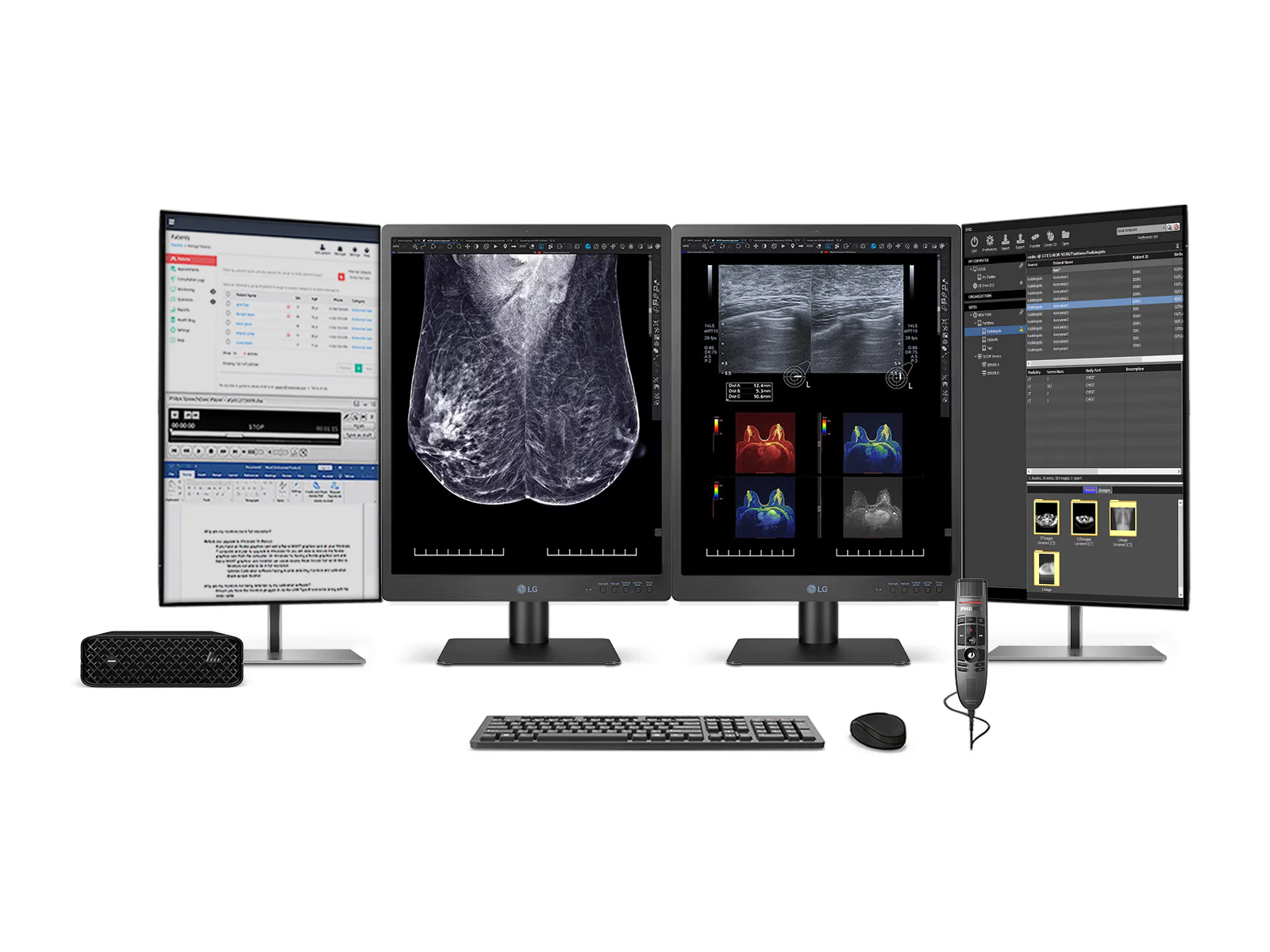 LG 5MP 21" 21HQ613D-B Color Mammography 3D-Tomosynthesis Breast Imaging Display Monitor 1 Complete Mammography Reading Station | LG 5MP 21" Color | HP Z2 Mini G9 Workstation | Dictation Mic | Worklist Monitors (21HQ613DZ2MNG9)