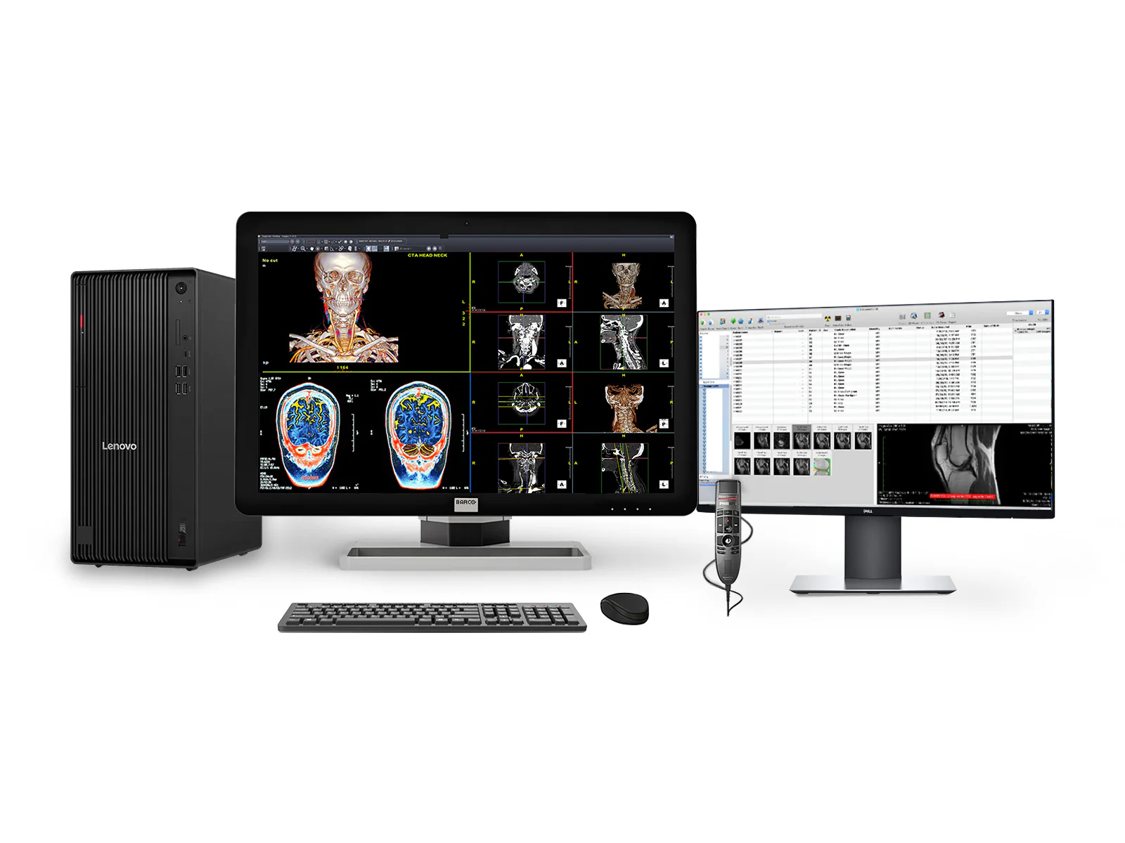 Complete PACS General Radiology Station | Eizo Radiforce MX215 2MP Color LED Displays | Business Class Workstation | Dictation Mic | Worklist Monitor (MX215M90T) 4 Complete PACS General Radiology Reading Station | Barco 6MP MDCC-6430 | Lenovo Workstation | Dictation Mic | 24" Worklist Monitors (6430Z4R)