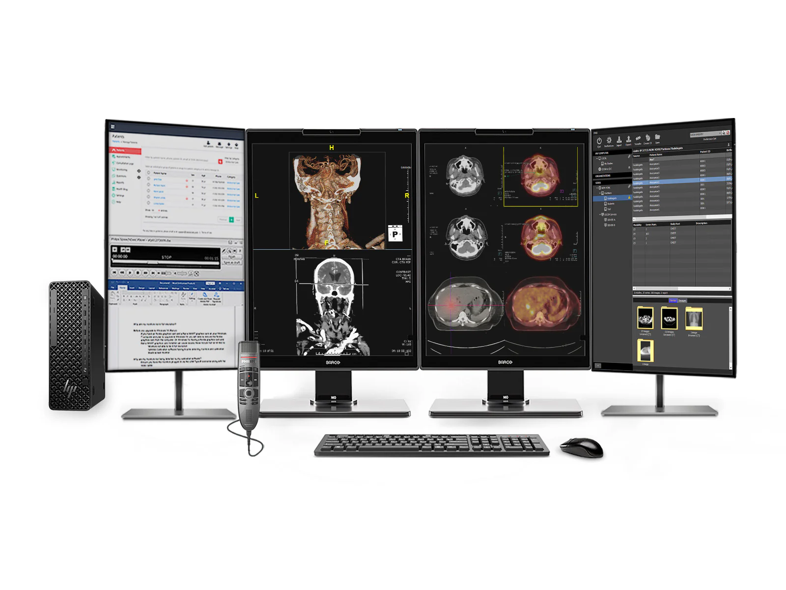 Complete PACS General Radiology Station | Eizo Radiforce MX215 2MP Color LED Displays | Business Class Workstation | Dictation Mic | Worklist Monitor (MX215Z2SFFG1i) 4 Complete PACS General Radiology Station | Barco 3MP Color LED MDNC-3521 | HP Z2 SFF G1i Workstation | Dictation Mic | Worklist Monitor (3521Z4G5)