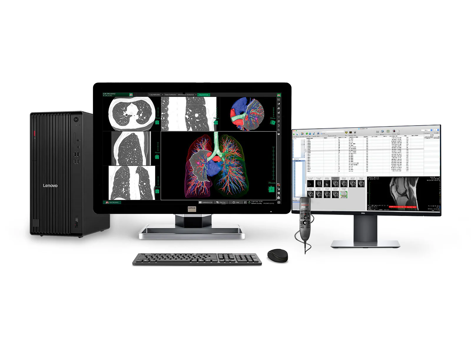 Complete PACS General Radiology Station | Barco Coronis MDCC-6330 6MP Color LED Display | Lenovo Workstation | Dictation Mic | Worklist Monitor (6330Z4R)