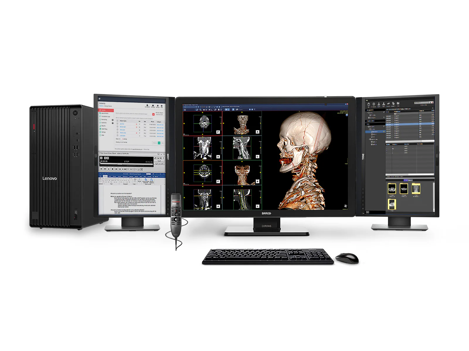 Complete PACS General Radiology Station | Barco Coronis MDCC-6530 6MP Color LED Display | Lenovo Workstation | Dictation Mic | Worklist Monitor (6530Z4R)