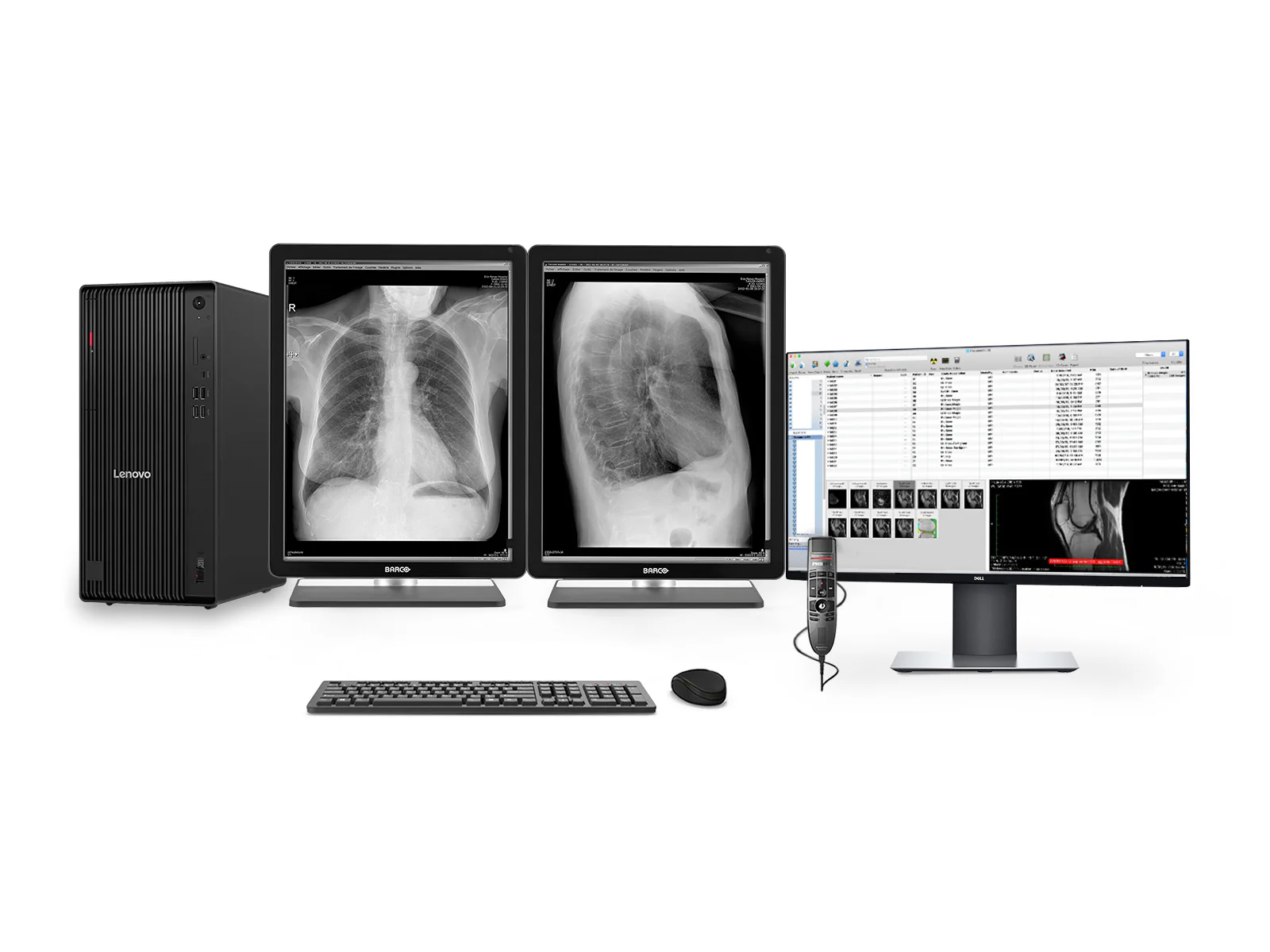 Complete PACS General Radiology Station | Barco Coronis MDCG-3221 3MP Grayscale LED Displays | Lenovo Workstation | Dictation Mic | Worklist Monitor (3221Z4R)