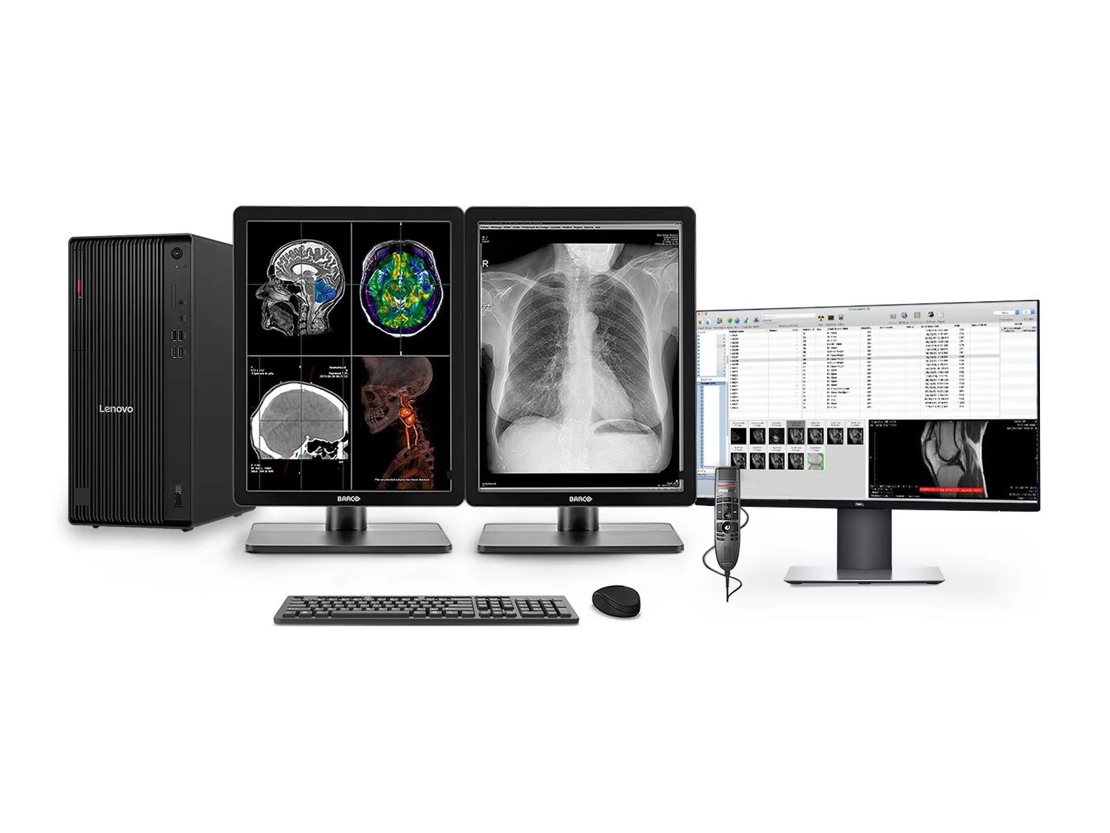 Complete PACS General Radiology Station | Barco Nio MDNC-3321 3MP Color LED Displays | Lenovo Workstation | Dictation Mic | Worklist Monitor (3321Z4R)