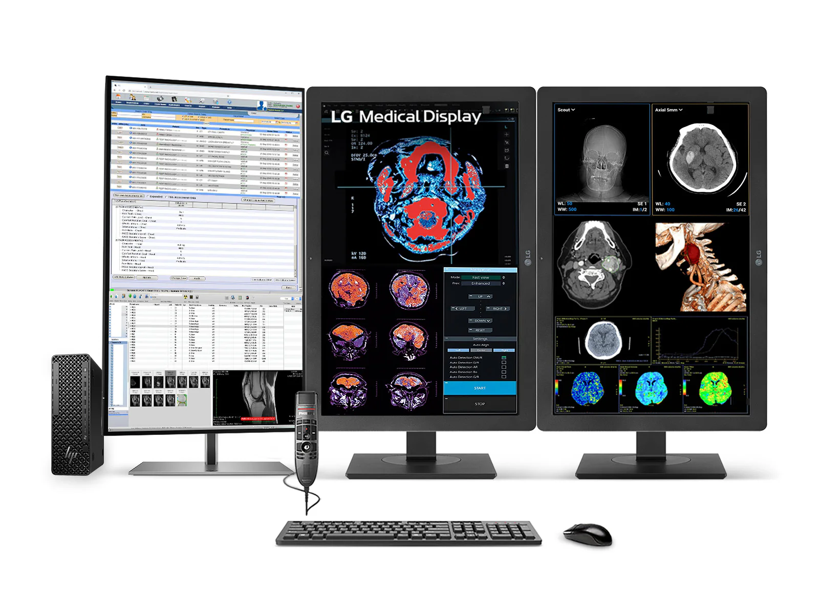 Complete PACS General Radiology Station | Dual LG 24" Color 2MP | HP Z2 SFF G1i Workstation | Dictation Mic | Worklist Monitor (24HR513CP3T)