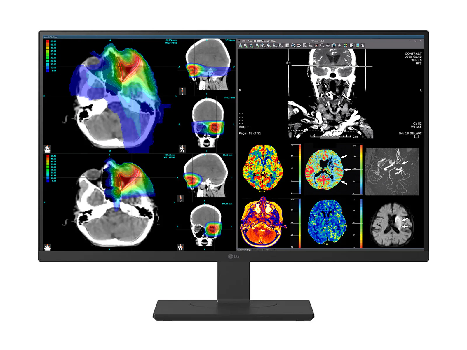 Complete PACS General Radiology Station | Dual LG 27" Color Fusion 8MP 4K | HP Z2 SFF G1i Workstation | Dictation Mic | Worklist Monitor (D27HS713CP3T)