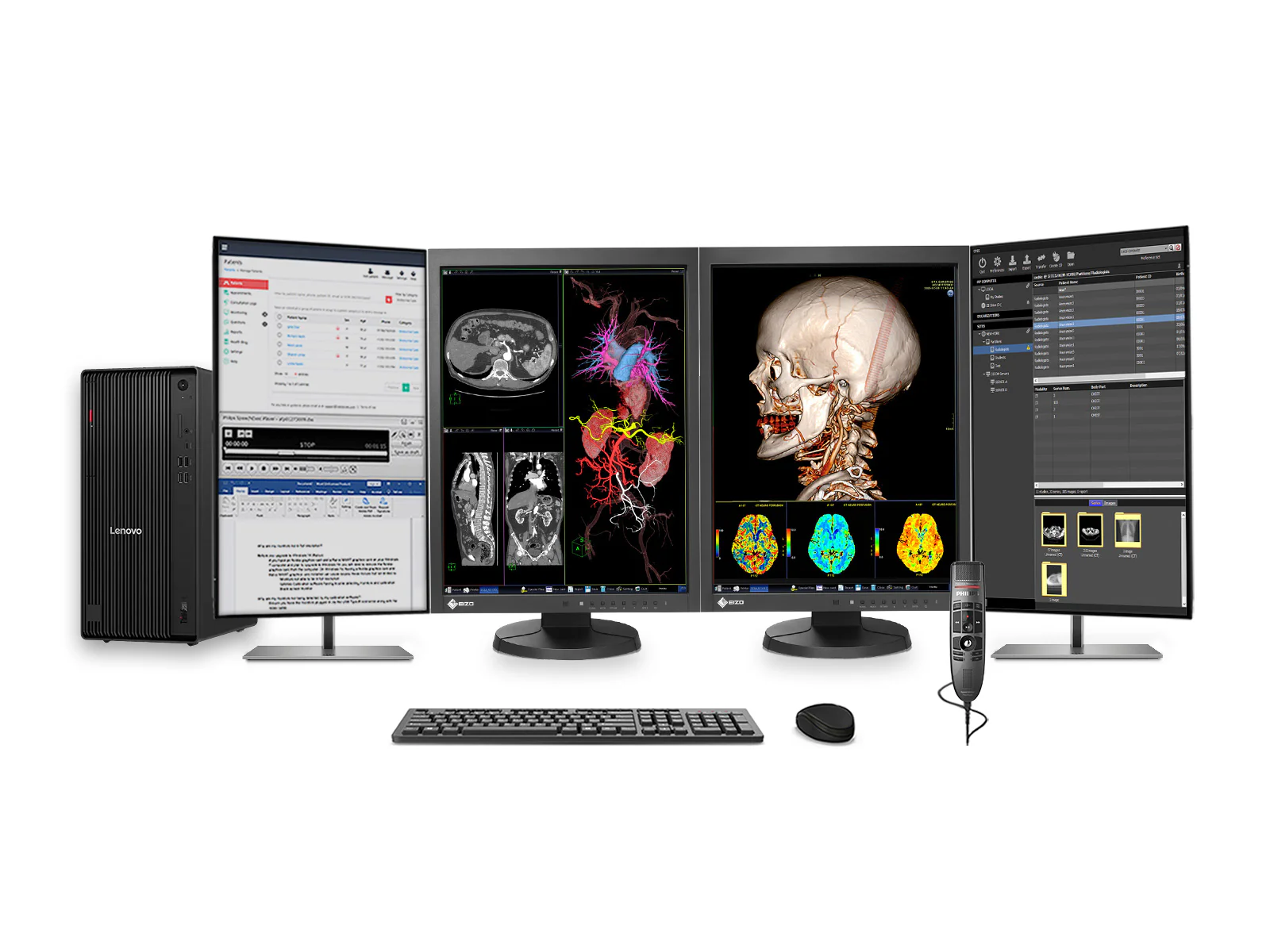 Complete PACS General Radiology Station | Eizo Radiforce MX215 2MP Color LED Displays | Business Class Workstation | Dictation Mic | Worklist Monitor (MX215M90T)