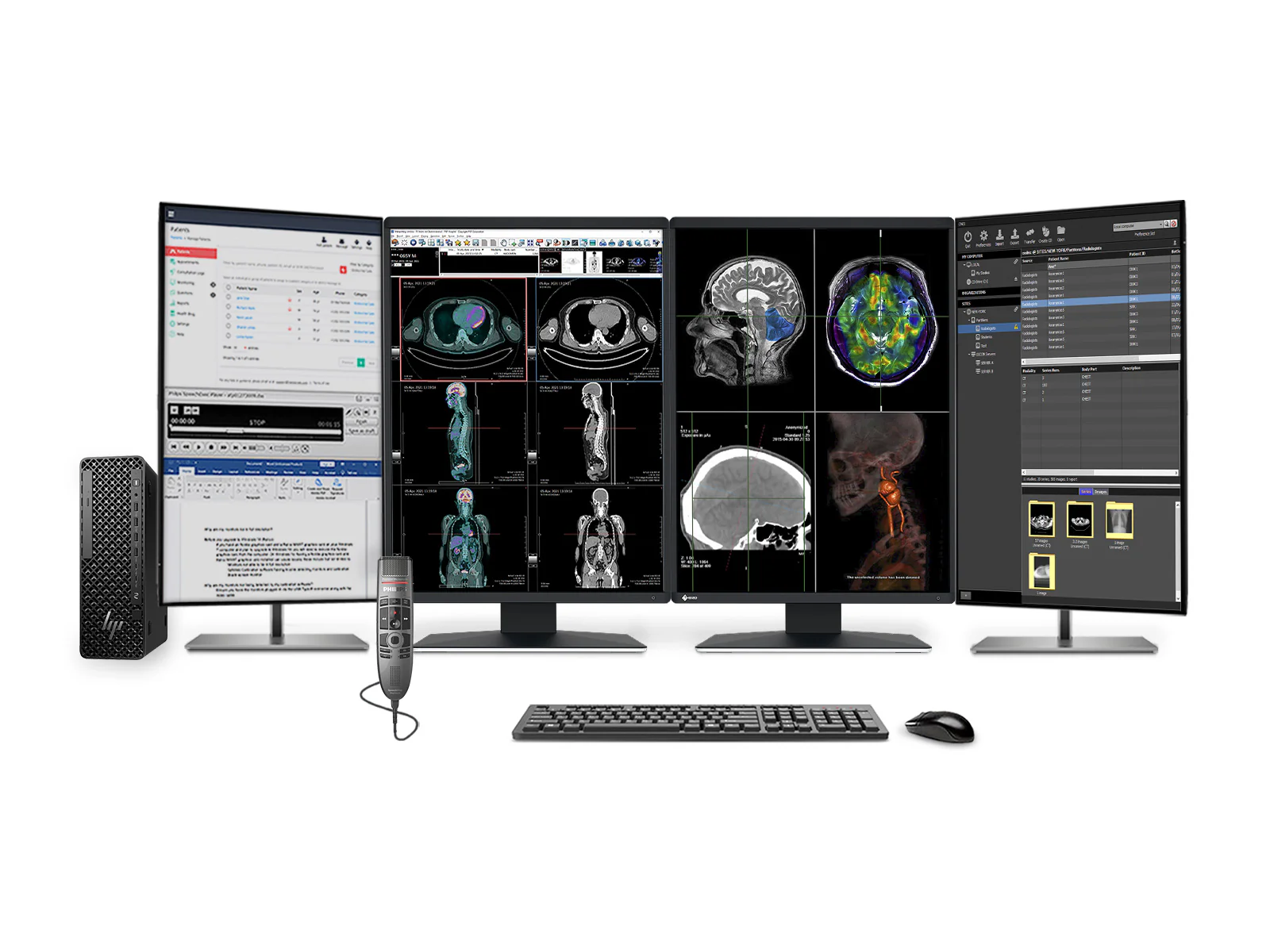 Complete PACS General Radiology Station | Eizo Radiforce RX370 3MP Color LED Displays | Business Class Workstation | Dictation Mic | Worklist Monitor (RX370Z4G5)