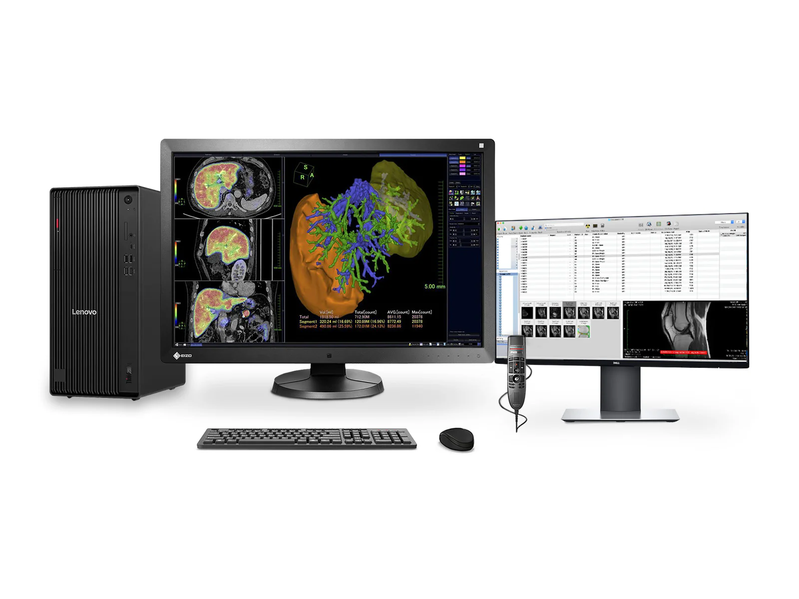 Complete PACS General Radiology Station | Eizo Radiforce RX650 6MP Color LED Display | Lenovo Workstation | Dictation Mic | Worklist Monitor (RX650Z4R)