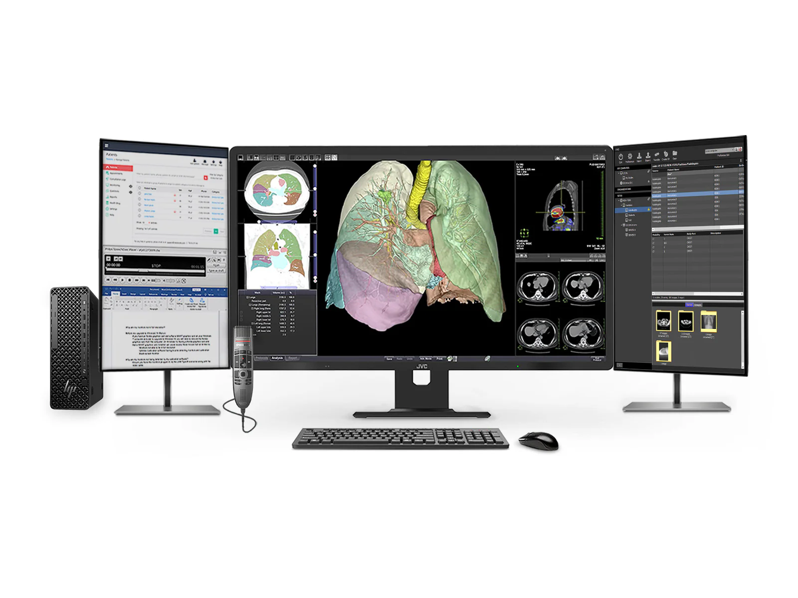 Complete PACS General Radiology Station | JVC CL-R813 8MP Color Display | Business Class Workstation | Dictation Mic | Worklist Monitor (R813Z4G5)