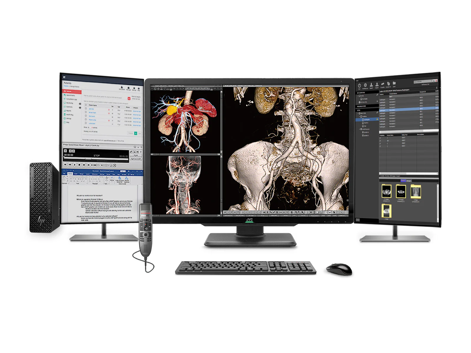 Complete PACS General Radiology Station | JVC CL-S600 6MP Color Display | Business Class Workstation | Dictation Mic | Worklist Monitor (S600Z4G5)
