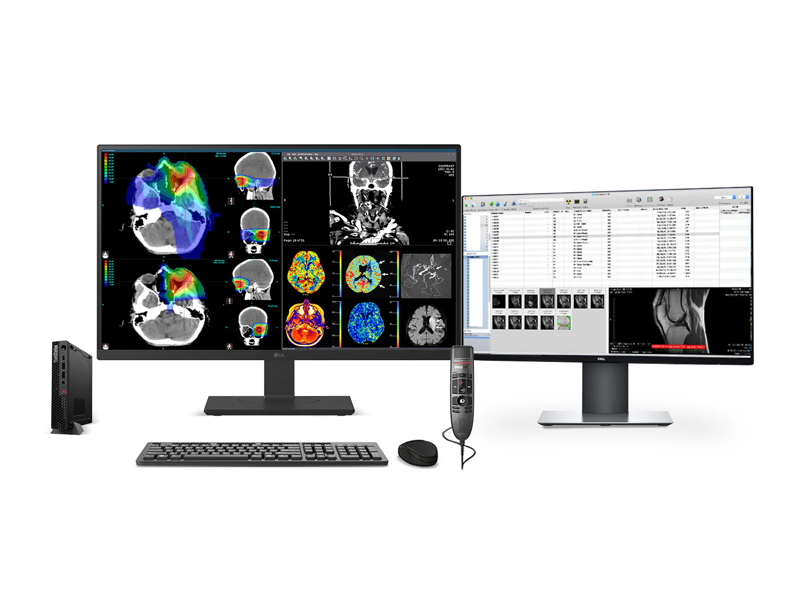 Complete PACS General Radiology Station | LG 27" Color Fusion 8MP 4K | Lenovo ThinkStation P3 Tiny Workstation | Dictation Mic | Worklist Monitor (27HS713CP3T)