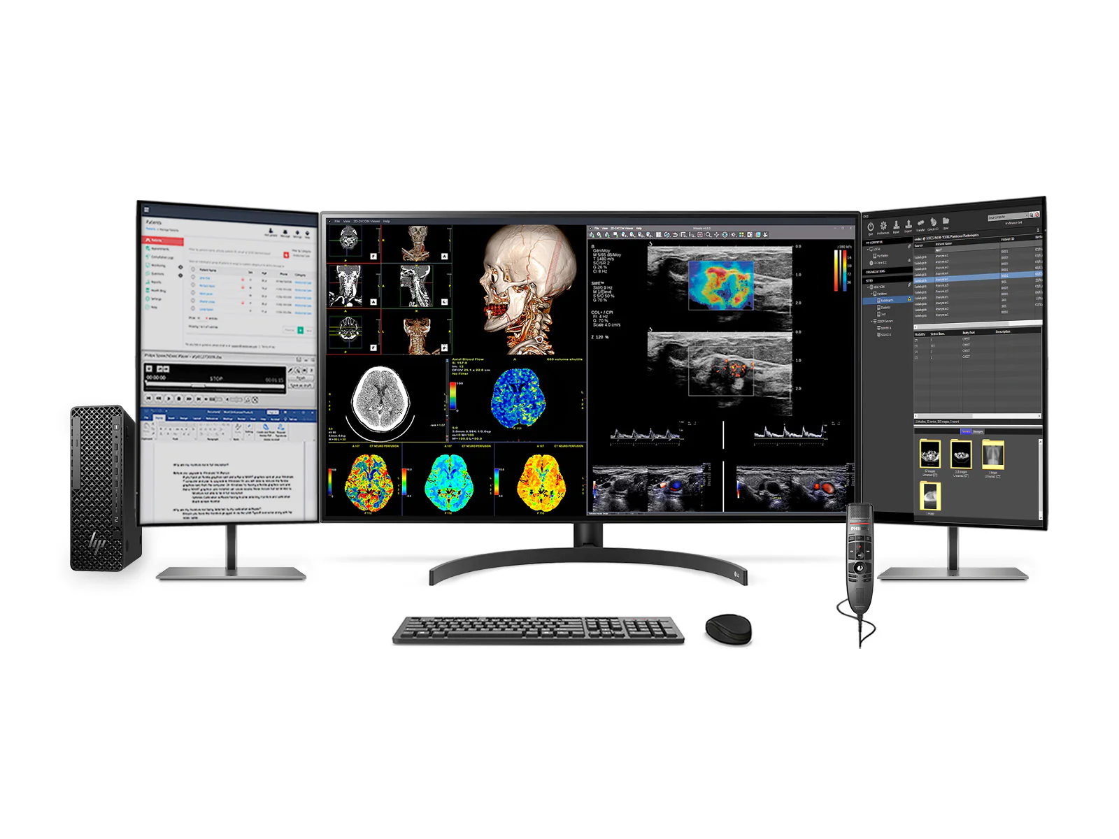 Complete PACS General Radiology Station | LG 32HL512D 8MP 32" Diagnostic Fusion Color | HP Z2 SFF G1i Workstation | Dictation Mic | Worklist Monitor (32HL512DZ2G9SFF)