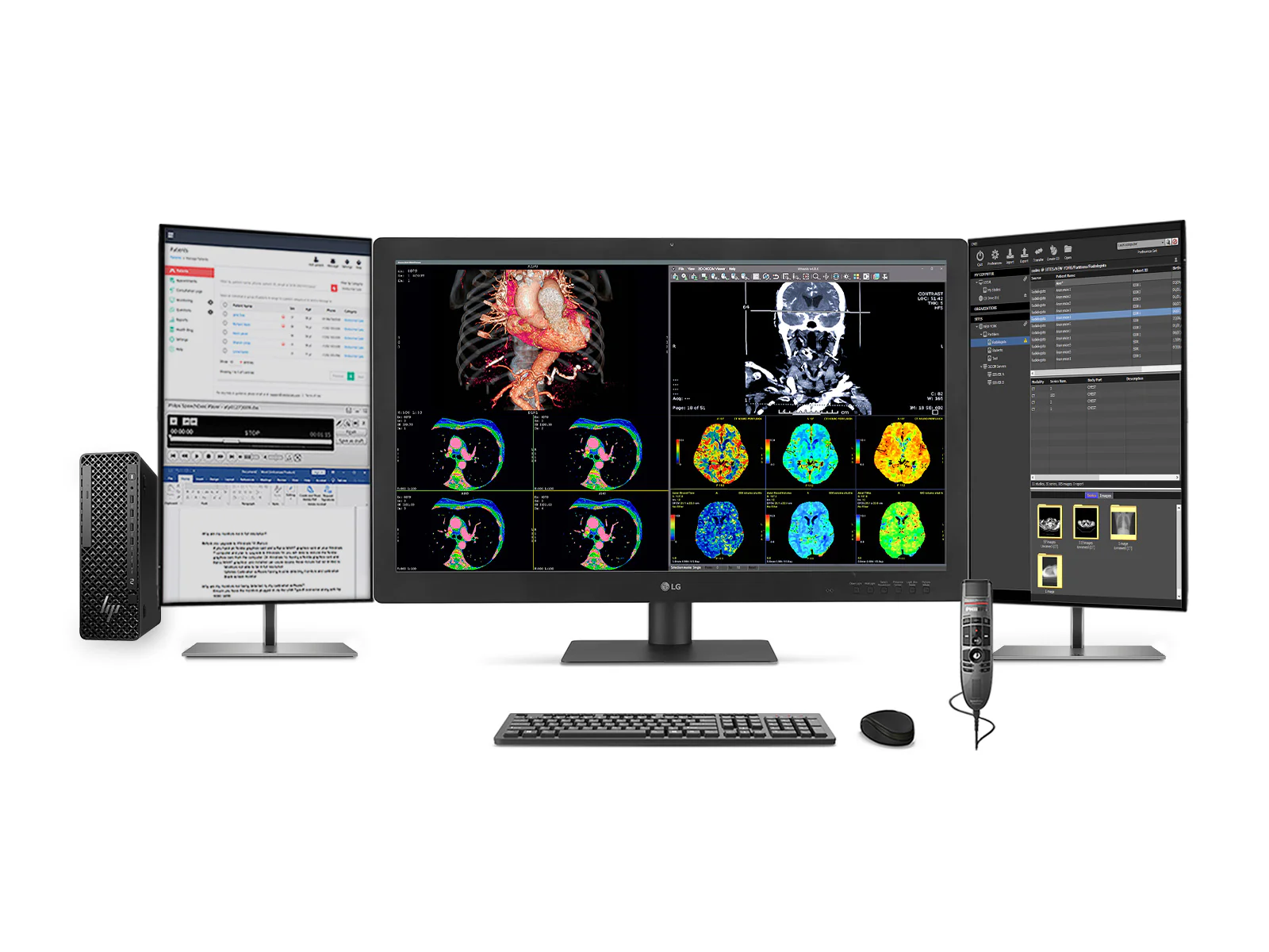 Complete PACS General Radiology Station | LG 32HQ713D 8MP 32" Diagnostic Fusion Color | HP SFF Z2 G1i Workstation | Dictation Mic | Worklist Monitor (32HQ713DZ2G9SFF)