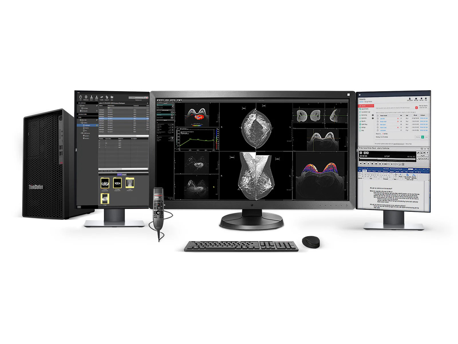 Complete PACS Mammography Reading Station | Eizo Radiforce RX850 8MP Color mammography Monitor | Business Class Workstation | Dictation Mic | Worklist Monitors (RX850P5)